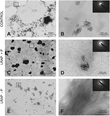 Phosphorylated and Non-phosphorylated Leucine Rich Amelogenin Peptide Differentially Affect Ameloblast Mineralization